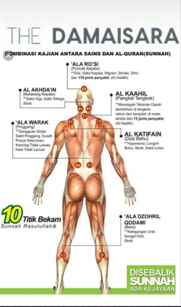 Bekam sunnah 13 cawan