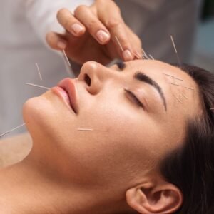 Facial Points Needling Therapy (R)